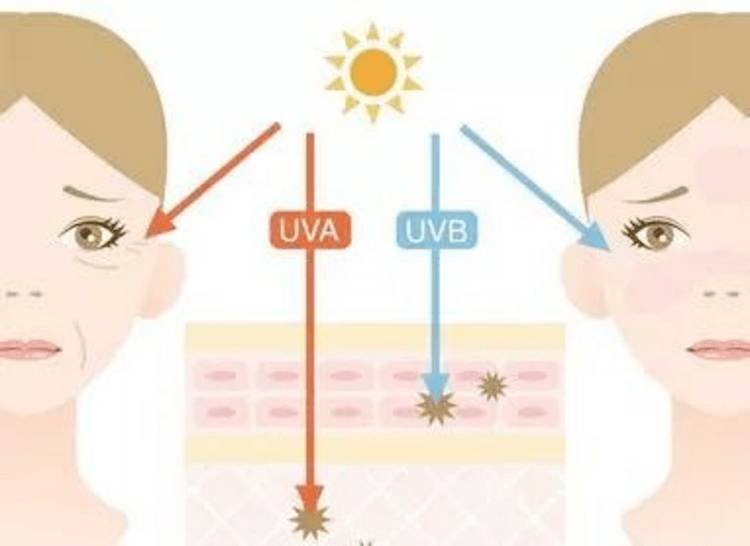 【UVLED固化小百科】UVLED紫外线的预防和缓解方法